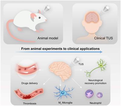 Transcranial ultrasound stimulation applied in ischemic stroke rehabilitation: A review